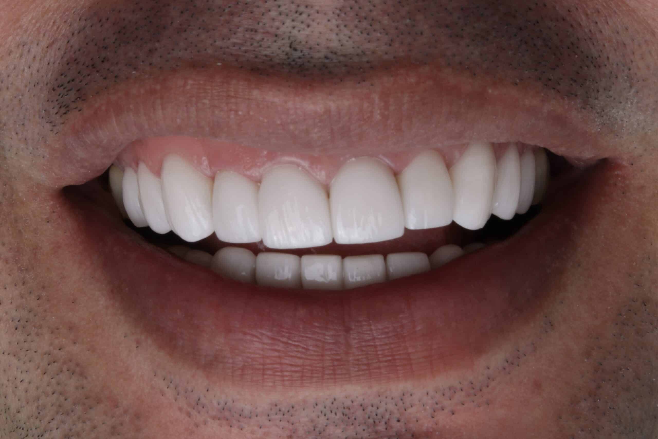 Odontología en Medellín Odontología en Medellín